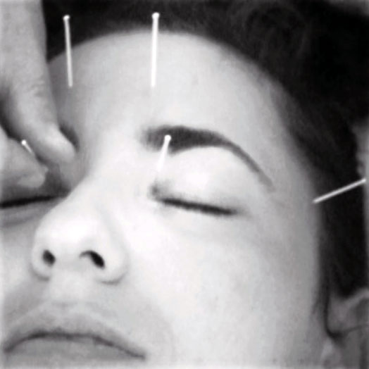 Agopuntura Sonia Apparuti